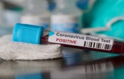 coronavirus positivo