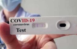 test sierologico coronavirus