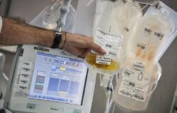 COVID 19, Terapia sperimentale, plasma iperimmune, Primiani, interrogazione