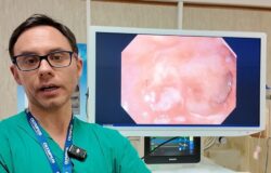 Ospedale, Cardarelli, ecoendoscopia