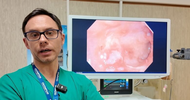 Ospedale, Cardarelli, ecoendoscopia