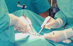 Cardarelli, prelievo, fegato