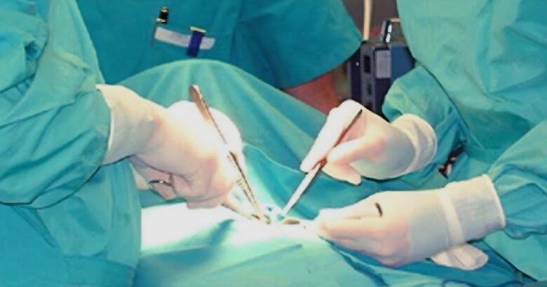 Cardarelli, prelievo, fegato